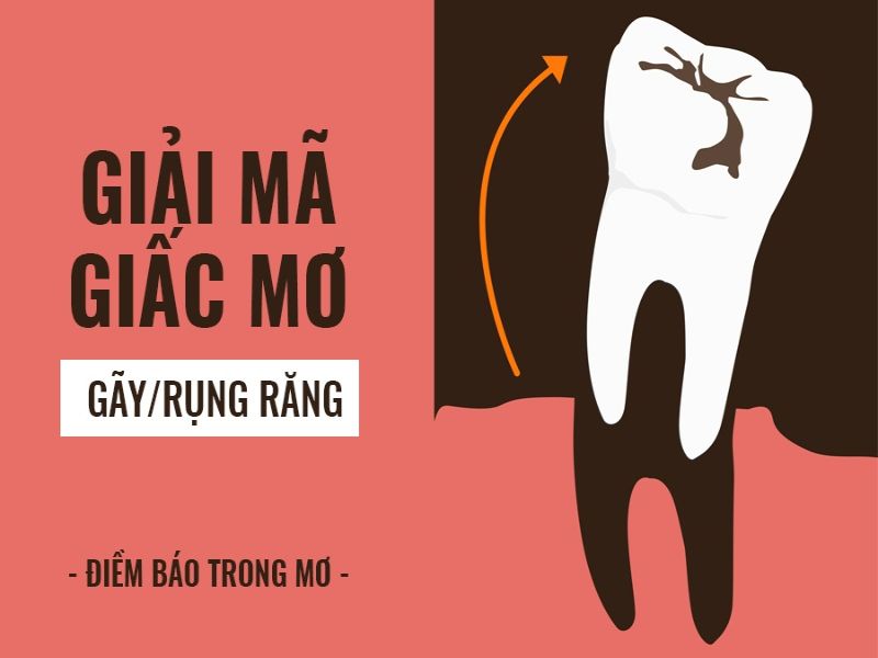 Giải mã giấc mơ rụng răng