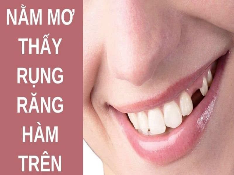 Mơ rụng răng hàm trên là điềm báo gì?